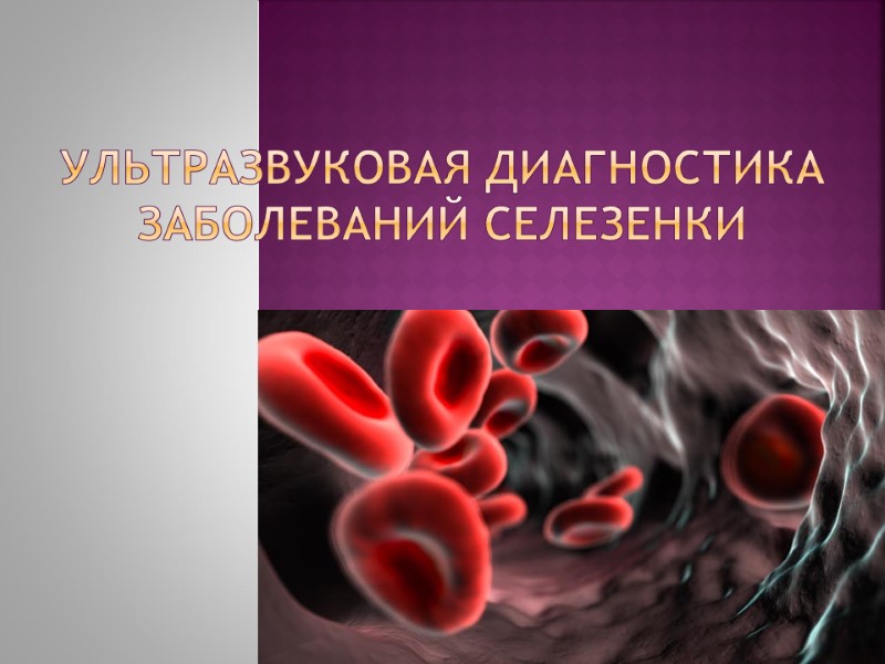 Ультразвуковая диагностика заболеваний селезенки